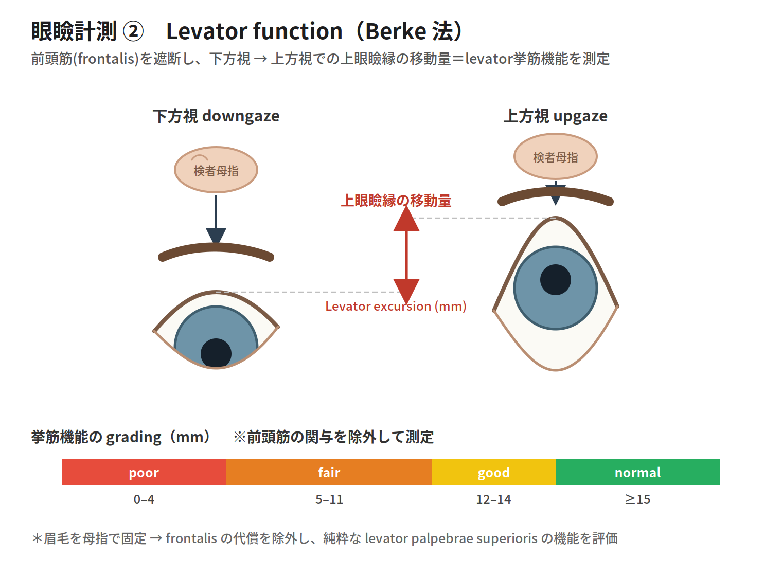 挙筋機能 Berke法