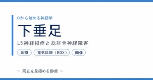 下垂足：L5神経根症と総腓骨神経障害の鑑別