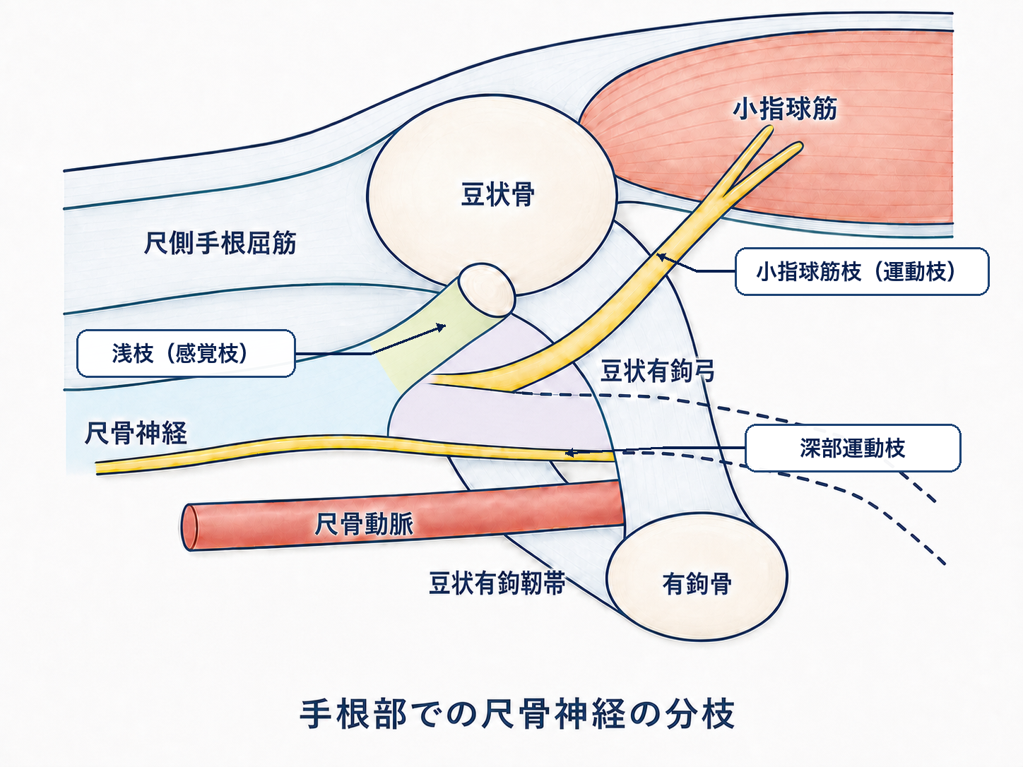 手根部尺骨神経の浅枝（感覚枝）、深部運動枝、小指球筋枝を指示線で示す医学教材風模式図
